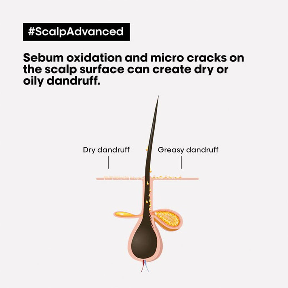 Loreal Professionnel Scalp Advanced Anti Dandruff Shampoo 1500ML