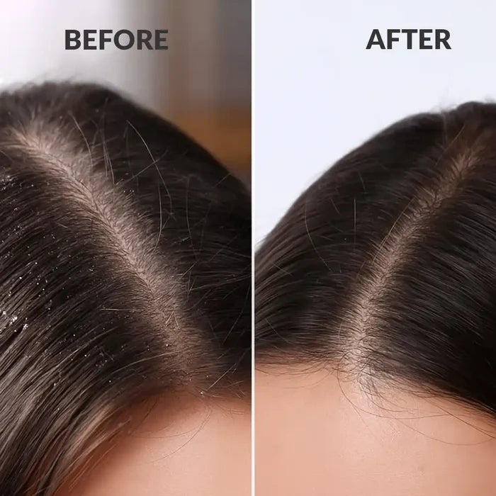 ScalpSense Hydra Soothe Shampoo-200ML