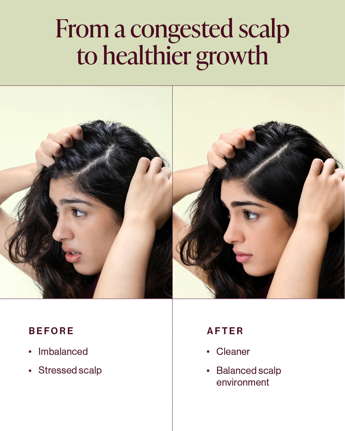 &Done Begin Again Balancing Shampoo-300ml