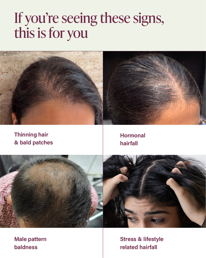 &Done Hairfall Rescue Kit Shampoo, Conditioner & Serum