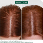 Matrix Biolage Scalp Sync Clarifying Shampoo 1000ml