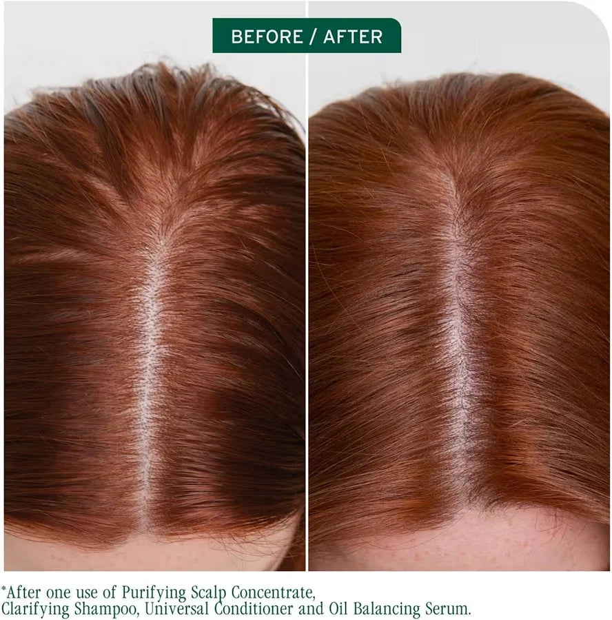 Matrix Biolage Scalp Sync Clarifying Shampoo 1000ml
